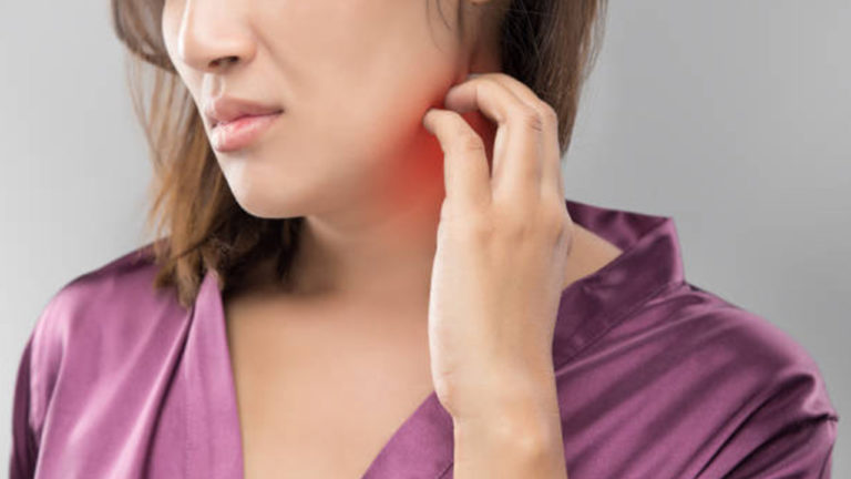 Shingles Symptoms and Treatment Health &amp; Fitness